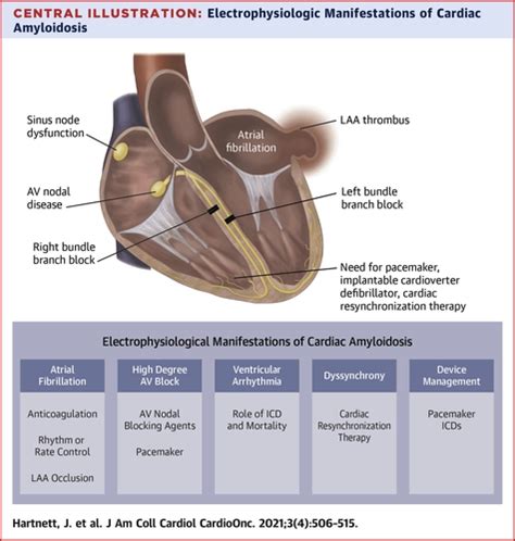 Clinical Electrophysiology Section .